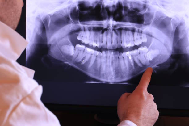 Best Emergency Treatment for Toothache in Fairmount, GA