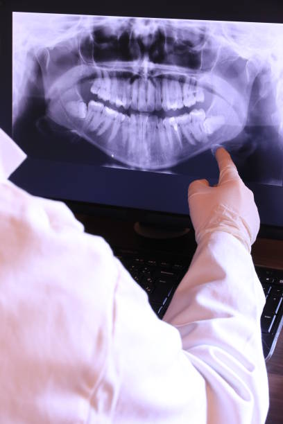 Best Emergency Tooth Extraction in Fairmount, GA