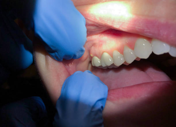 Best Emergency Orthodontic Repairs in Fairmount, GA