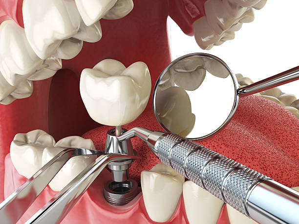 Best Emergency Dental Care for Trauma or Injury in Fairmount, GA